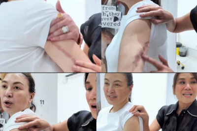Sinabi ni Sharon Cuneta ang nakakakilabot na katotohanan tungkol sa mga peklat mula sa sobrang pagtanggal ng balat. “Hindi mo maisip ang sakit na tiniis ko”/hi