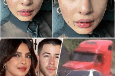 Bollywood Actor Priyanka Chopra Ki Car Accident Mein Hue Death
