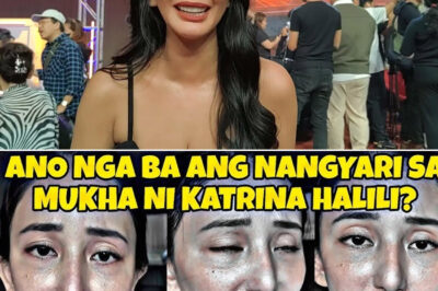 Oh my gosh! Look what happened to KATRINA HALILI’S face — FANS ARE TOTALLY SHOCKED! /hi